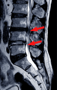 整形外科に行くべき腰痛の症状3選！！！