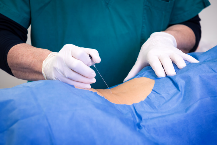 腰椎椎間板ヘルニアの治療