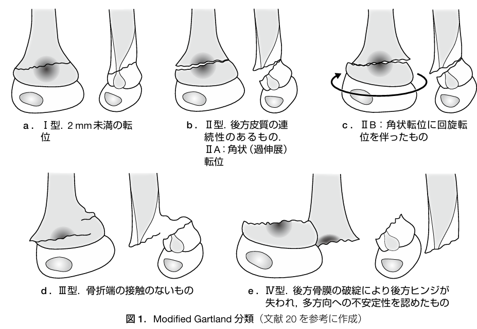 神経血管損傷の有無やコンパートメント症候群の有無を確認