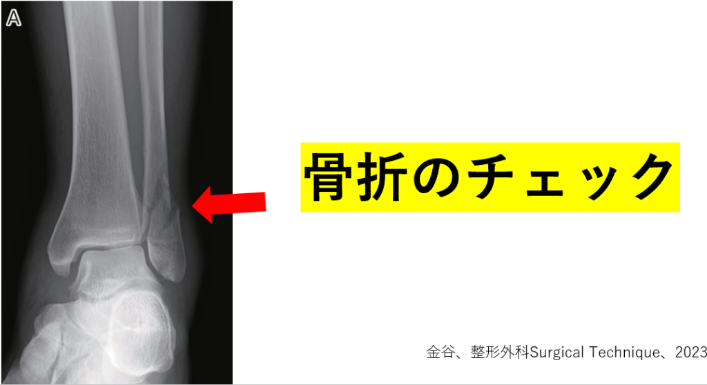 レントゲンやエコー