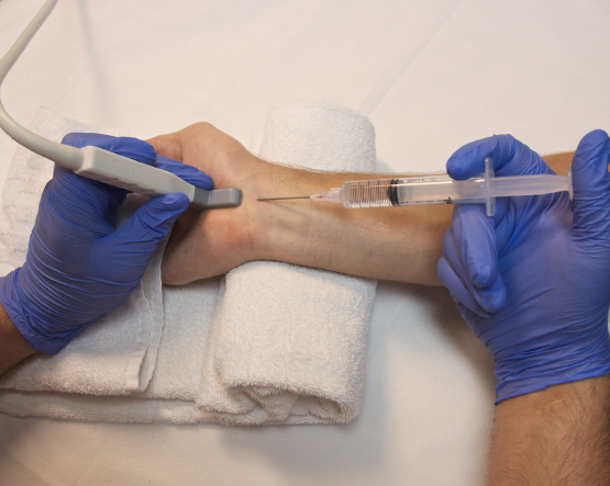 手根管症候群の治療