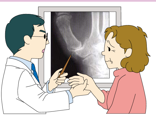 母指CM関節症の診断