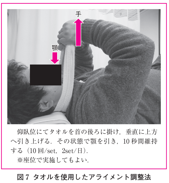 タオルを用いたアライメント調整法