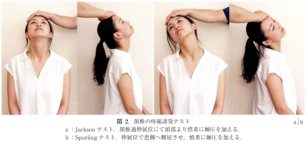 頸椎椎間板ヘルニアの診断