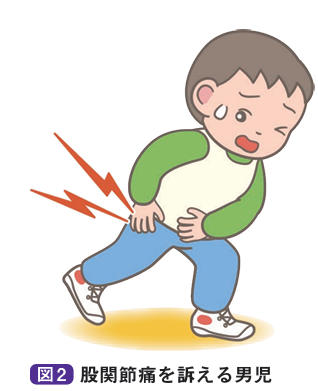 股関節痛