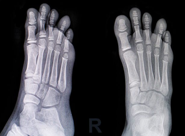 レントゲン画像