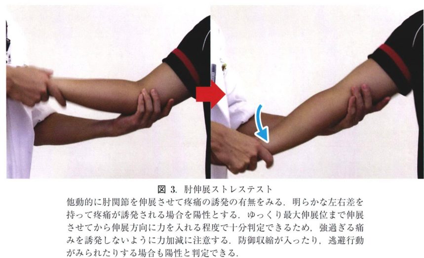 肘伸展ストレステスト