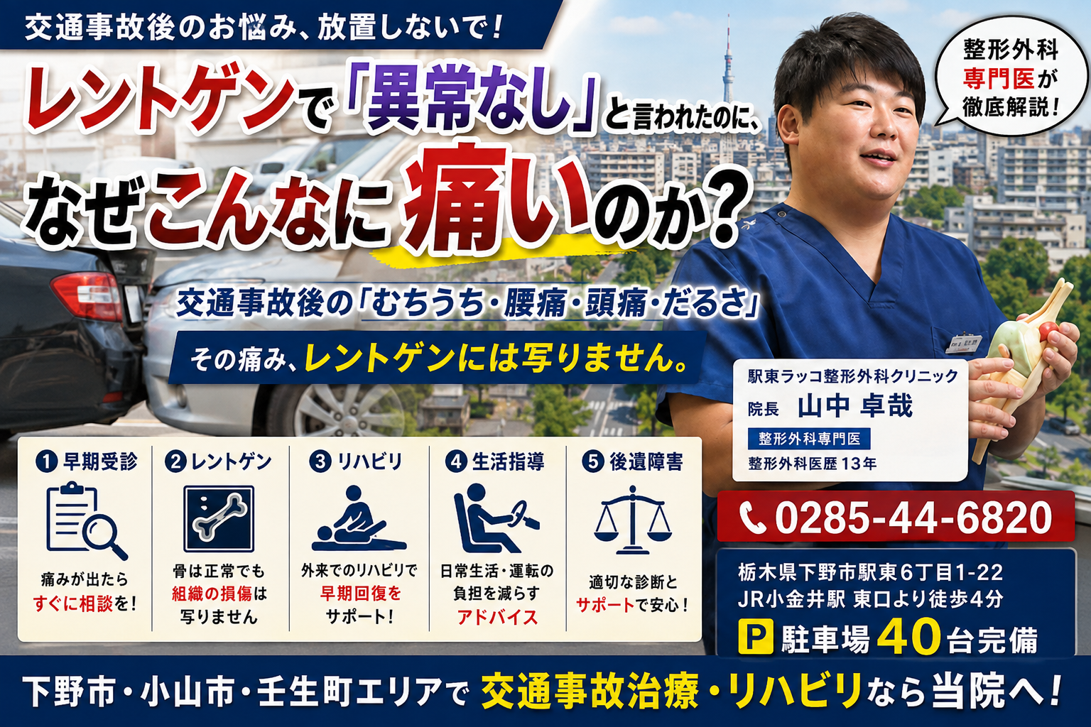 交通事故の「レントゲン異常なし」で放置は危険！下野市・小山市で交通事故治療経験豊富な整形外科医が解説！