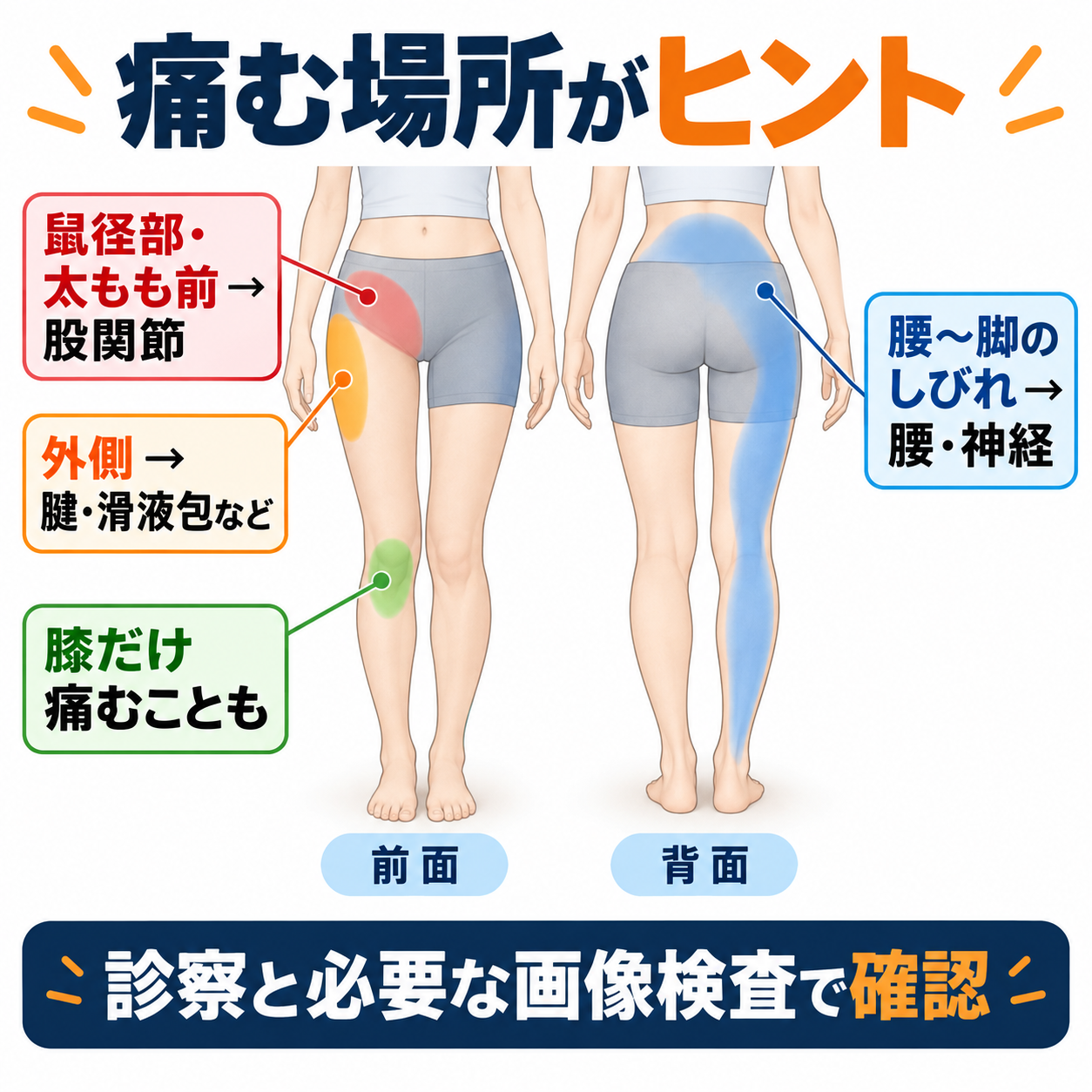 鼠径部、股関節外側、腰から脚、膝に出る痛みの違い